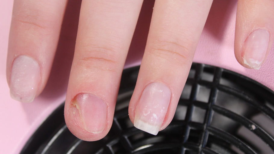 You Cannot be in a Rush When you Treat Nail Fungus