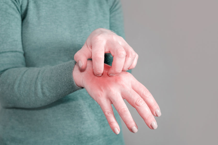 How Serious is Scabies and What is the Solution?