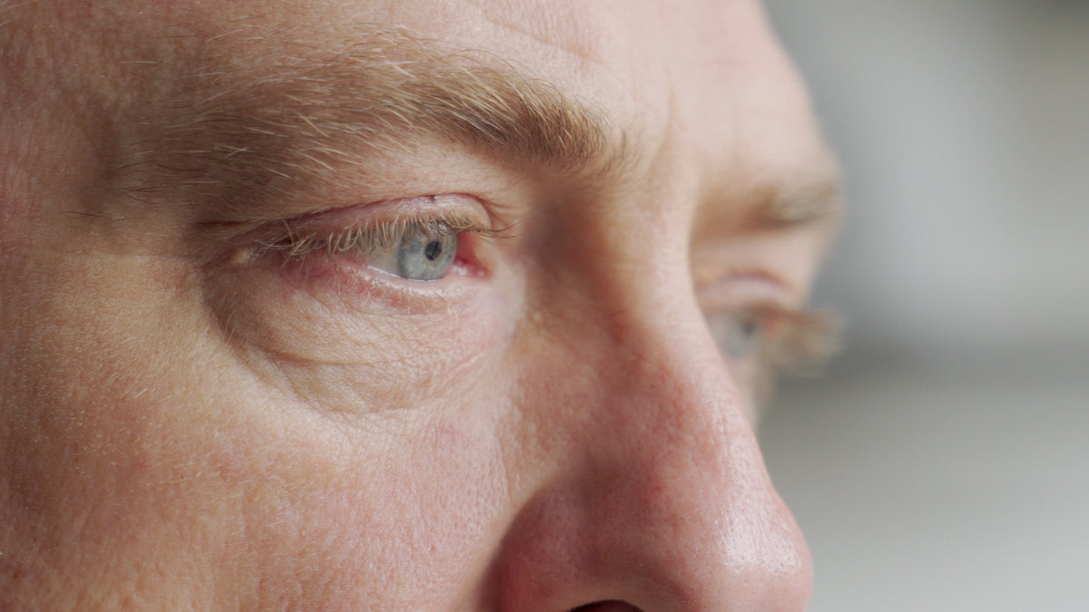Eyelid shop skin tag