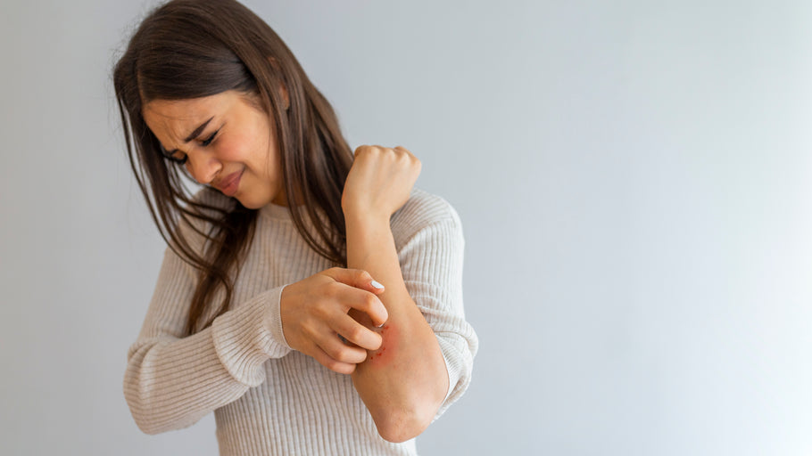 Relief From Seven Types of Eczema