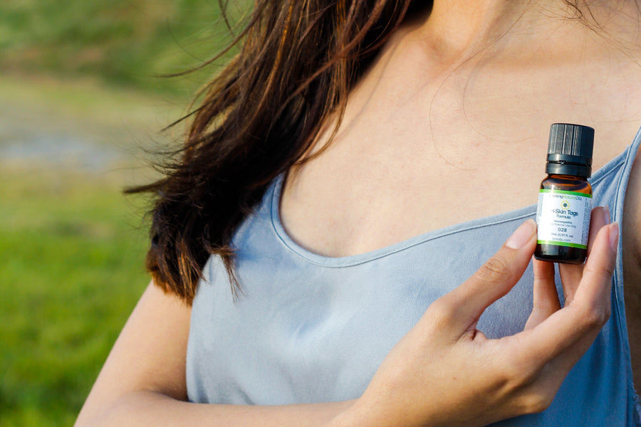 Do You Have Skin Tags?
