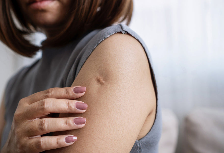 10 Must-Knows Before Laser Scar Treatment