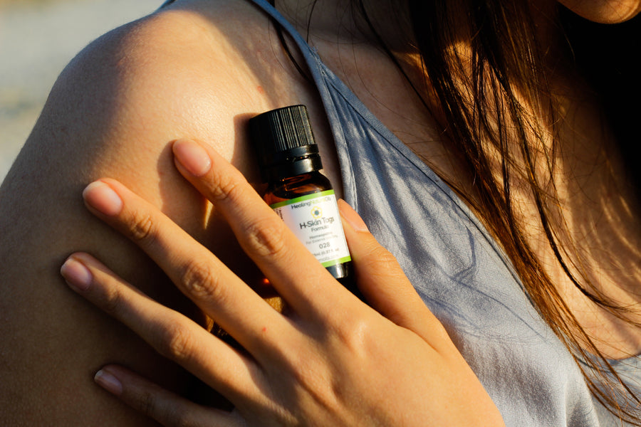 Got Embarrassing Skin Tags?