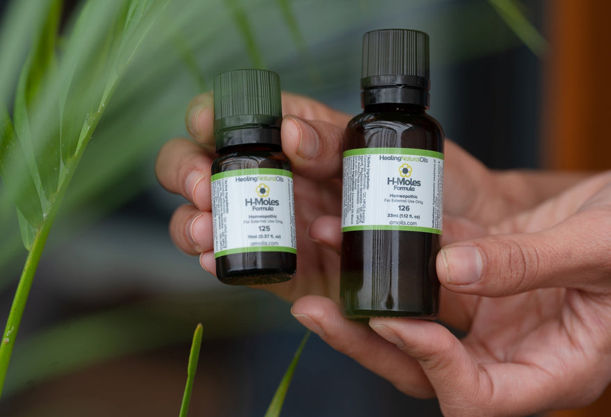 The Natural Approach to Caring for Moles