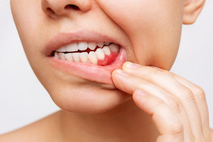 Why do our Gums Become Swollen or Bleed?