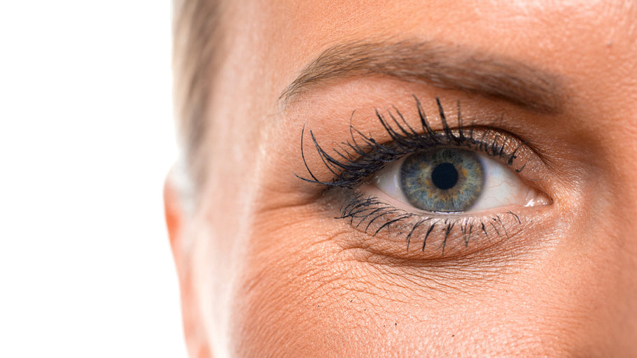 Top Natural Solution for Eye Wrinkles
