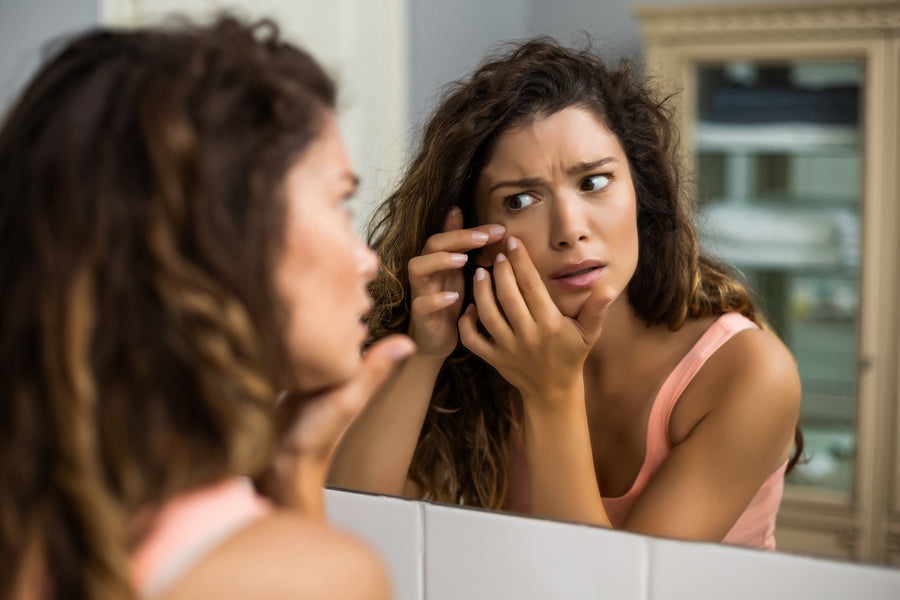 What To Do When Acne Outbreaks Lead to Scars