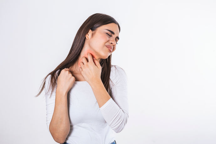 How To Treat The Symptoms of Eczema Naturally