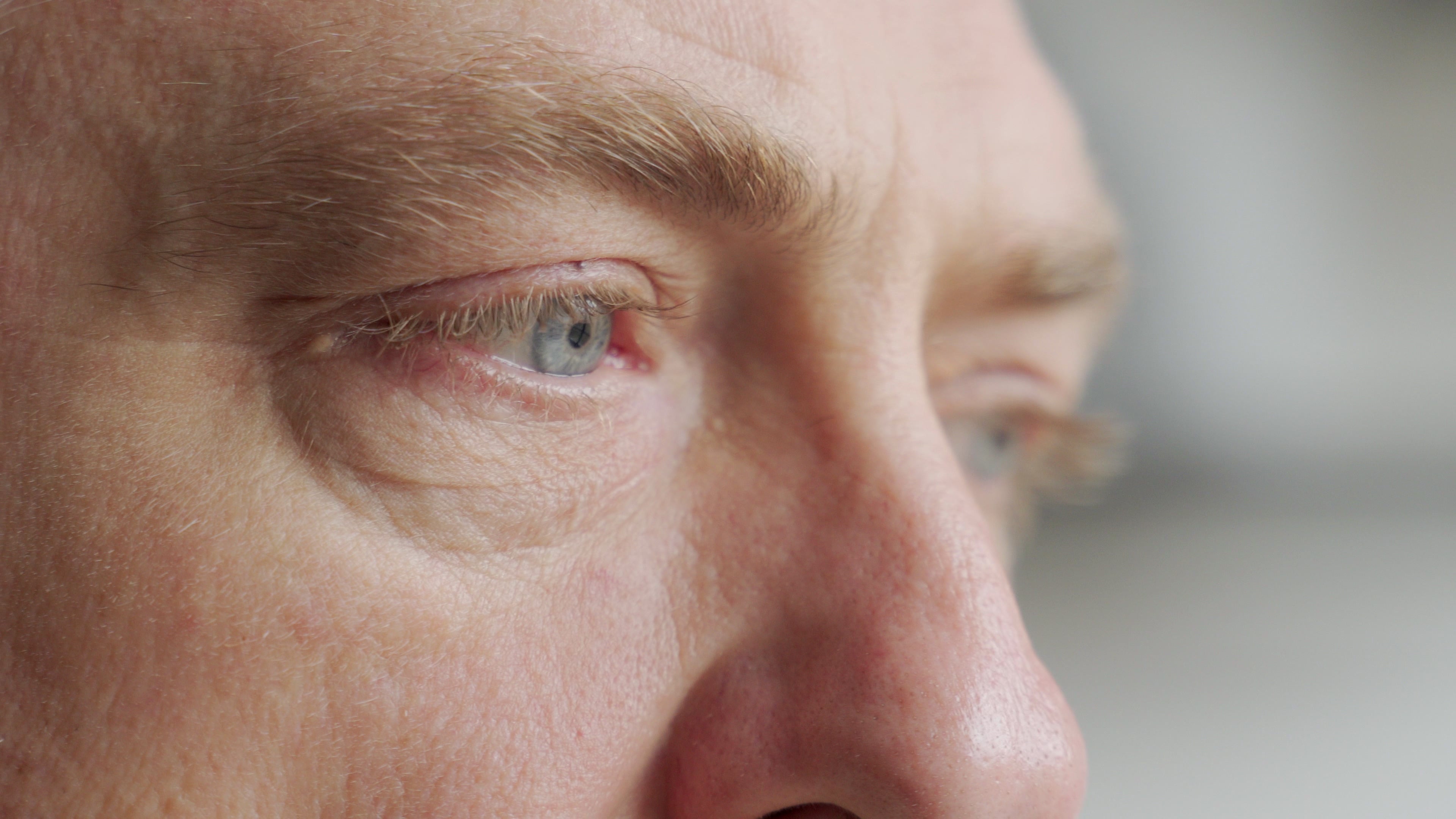 Skin tag sales under eye
