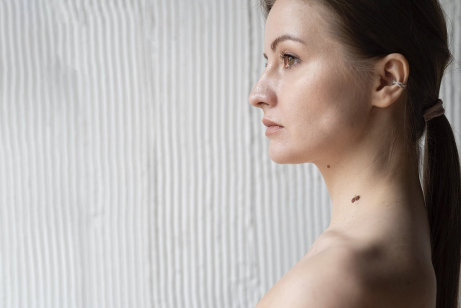 Unwanted Skin Mole or A Warning Sign?